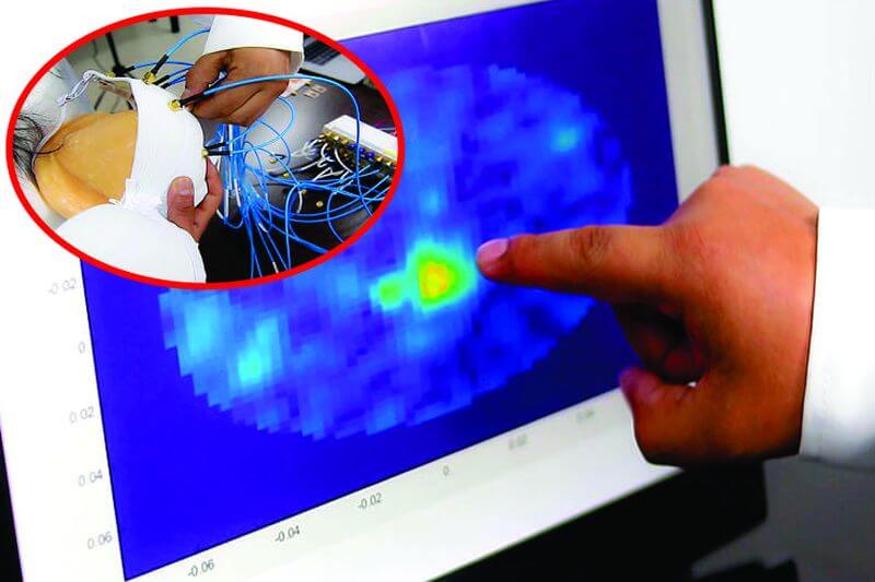 MABIS, el brasier que ayudará a masificar la detección temprana de cáncer de mama.