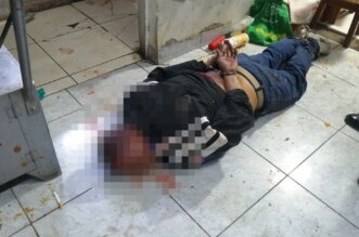 Arequipa: Comerciante herido de bala, tras resistirse a asalto en su tienda en Cerro Colorado