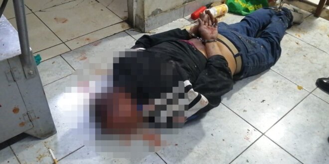 Arequipa: Comerciante herido de bala, tras resistirse a asalto en su tienda en Cerro Colorado