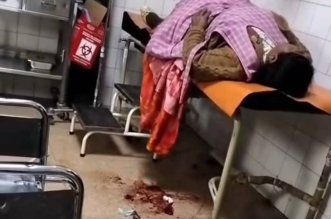 pirotecnico explota y deja herida a comerciante 1