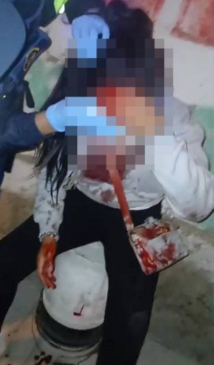 Tacna: Mujer queda desfigurada tras choque y chofer huye 1 abri alternaaa