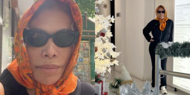 magaly medina responde burlas cirugia 800x533 1